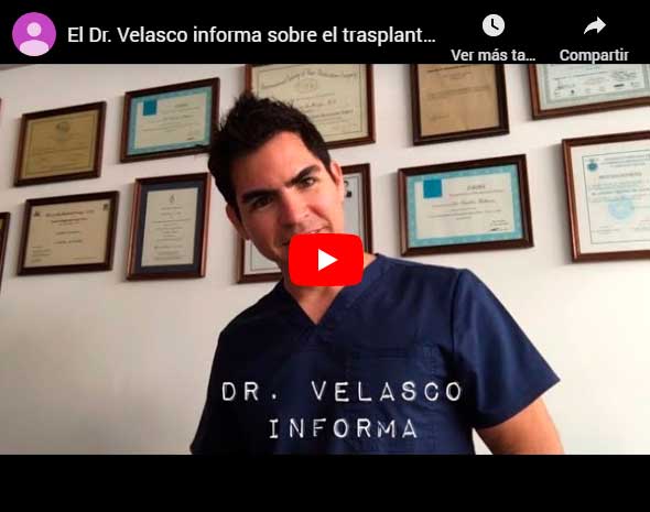 El Dr. Velasco informa sobre el Trasplante Capilar con Vello Corporal