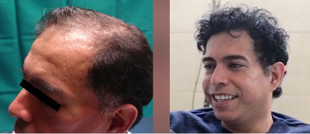 Nuestro paciente: Ernesto Pimentel, antes y después.